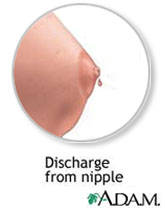Breast Leakage Not Pregnant 109
